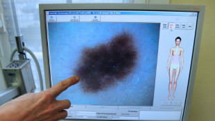 Le cancer de la peau, une r&eacute;alit&eacute; bien bretonne