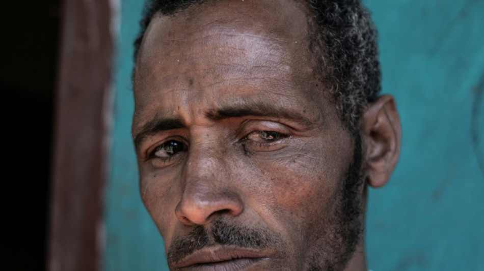 "Je m'arrache les cils pour soulager l'inconfort": en Ethiopie, le fl&eacute;au du trachome