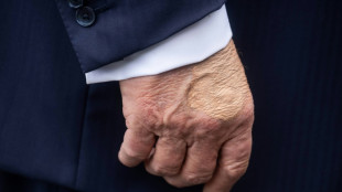 Trump diagnosed with vein issue after leg swelling, hand bruising