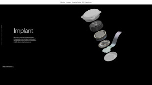 Neuralink, primo video su YouTube realizzato col pensiero