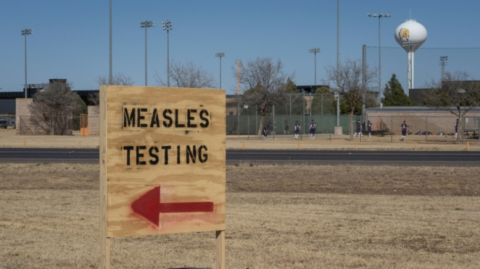 L'&eacute;pid&eacute;mie de rougeole aux Etats-Unis d&eacute;passe les 1.000 cas et trois morts