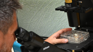 Lupus, bene primi risultati su 5 pazienti con cellule Car T