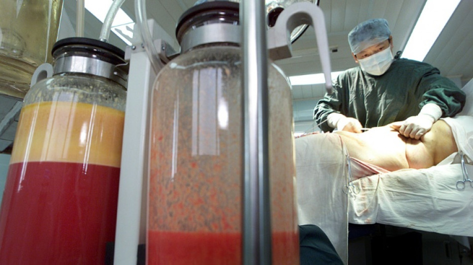 Inician una investigaci&oacute;n en Turqu&iacute;a por la muerte de una "influencer" brasile&ntilde;a en una liposucci&oacute;n