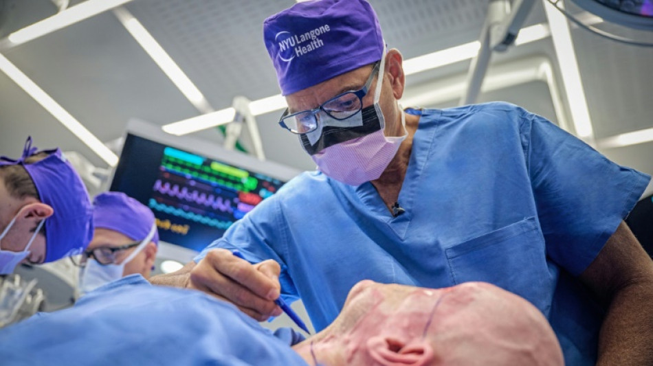 Ärzte in den USA transplantieren weltweit erstmals komplettes Auge