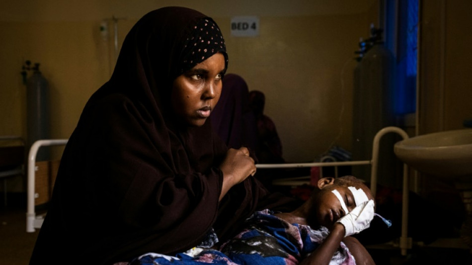 Somalie: dans un h&ocirc;pital de Mogadiscio, l'afflux des enfants victimes de la s&eacute;cheresse 