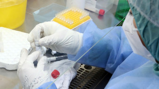 Spallanzani-Sacco, profilassi Hiv pre- esposizione pi&ugrave; efficace