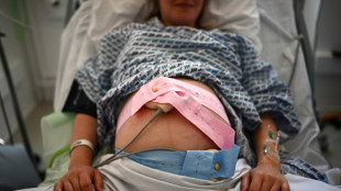 La majorit&eacute; des d&eacute;c&egrave;s li&eacute;s &agrave; une grossesse aux Etats-Unis sont &eacute;vitables