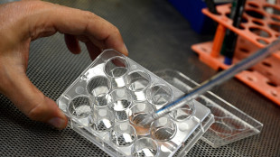 IA per biomedicina, all'Universit&agrave; Torino i primi laureati