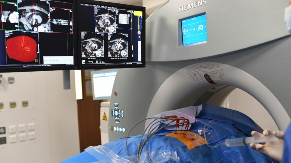 Los c&aacute;nceres afectan cada vez m&aacute;s a los j&oacute;venes