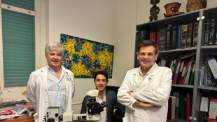 Scoperta una nuova classe di farmaci che silenzia il virus Hiv